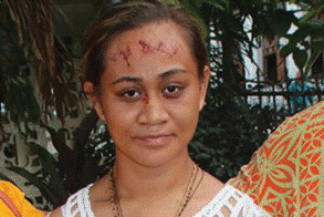 Название: Стигматы на лбу - описание: Стигматы на лбу